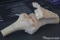 VBS_3068 - Artrite - Mostra Body Worlds